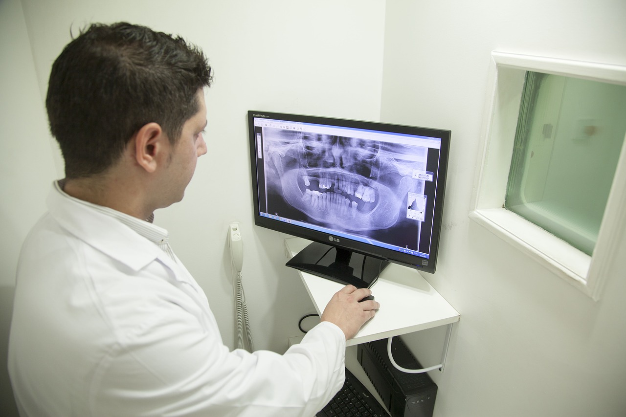 dental x ray, dental radiology, dentist x ray