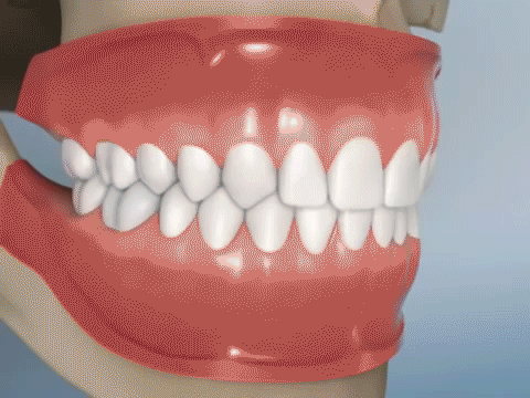 dental filling kenosha, kenosha dentist, tooth pain kenosha