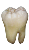 tooth extractions kenosha, kenosha tooth extraction, cavity kenosha